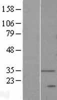 DEGS1 Protein - Western validation with an anti-DDK antibody * L: Control HEK293 lysate R: Over-expression lysate