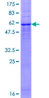 DEGS1 Protein - 12.5% SDS-PAGE of human DEGS1 stained with Coomassie Blue