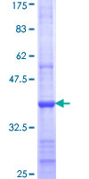 DEGS1 Protein - 12.5% SDS-PAGE Stained with Coomassie Blue.