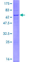 DEGS2 Protein - 12.5% SDS-PAGE of human DEGS2 stained with Coomassie Blue