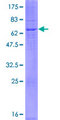 DEGS2 Protein - 12.5% SDS-PAGE of human DEGS2 stained with Coomassie Blue