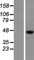 DEK Protein - Western validation with an anti-DDK antibody * L: Control HEK293 lysate R: Over-expression lysate