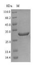 Delta-6 Desaturase / FADS2 Protein - (Tris-Glycine gel) Discontinuous SDS-PAGE (reduced) with 5% enrichment gel and 15% separation gel.