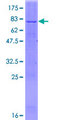 Delta-6 Desaturase / FADS2 Protein - 12.5% SDS-PAGE of human FADS2 stained with Coomassie Blue