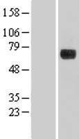DENND1A Protein - Western validation with an anti-DDK antibody * L: Control HEK293 lysate R: Over-expression lysate