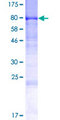 DENND1A Protein - 12.5% SDS-PAGE of human DENND1A stained with Coomassie Blue