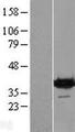 DENND1B Protein - Western validation with an anti-DDK antibody * L: Control HEK293 lysate R: Over-expression lysate