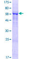 DENND1B Protein - 12.5% SDS-PAGE of human DENND1B stained with Coomassie Blue