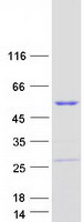 DENND1B Protein - Purified recombinant protein C1orf218 was analyzed by SDS-PAGE gel and Coomassie Blue Staining