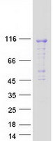 DENND1C Protein - Purified recombinant protein DENND1C was analyzed by SDS-PAGE gel and Coomassie Blue Staining
