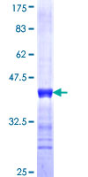 DENND4A Protein - 12.5% SDS-PAGE Stained with Coomassie Blue.