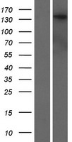 DENND5B Protein - Western validation with an anti-DDK antibody * L: Control HEK293 lysate R: Over-expression lysate