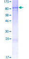 DENND6B Protein - 12.5% SDS-PAGE of human FAM116B stained with Coomassie Blue