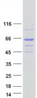 DENND6B Protein - Purified recombinant protein DENND6B was analyzed by SDS-PAGE gel and Coomassie Blue Staining