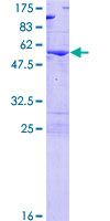 DENR / Density Regulated Protein - 12.5% SDS-PAGE of human DENR stained with Coomassie Blue