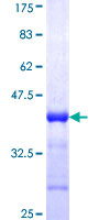 DENR / Density Regulated Protein - 12.5% SDS-PAGE Stained with Coomassie Blue.