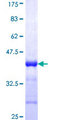 DENR / Density Regulated Protein - 12.5% SDS-PAGE Stained with Coomassie Blue.