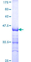 DEPDC1 Protein - 12.5% SDS-PAGE Stained with Coomassie Blue.