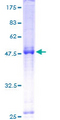 DEPDC1B Protein - 12.5% SDS-PAGE of human DEPDC1B stained with Coomassie Blue