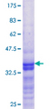 DEPDC1B Protein - 12.5% SDS-PAGE Stained with Coomassie Blue.