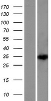 DEPDC4 Protein - Western validation with an anti-DDK antibody * L: Control HEK293 lysate R: Over-expression lysate