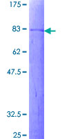 DEPDC7 Protein - 12.5% SDS-PAGE of human LOC91614 stained with Coomassie Blue