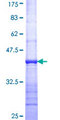 DEPDC7 Protein - 12.5% SDS-PAGE Stained with Coomassie Blue.