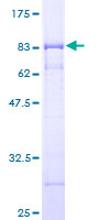 DEPTOR / DEPDC6 Protein - 12.5% SDS-PAGE of human DEPDC6 stained with Coomassie Blue