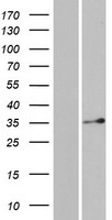 DERA Protein - Western validation with an anti-DDK antibody * L: Control HEK293 lysate R: Over-expression lysate