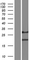 DERL1 / Derlin 1 Protein - Western validation with an anti-DDK antibody * L: Control HEK293 lysate R: Over-expression lysate