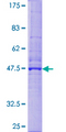 DERL1 / Derlin 1 Protein - 12.5% SDS-PAGE of human DERL1 stained with Coomassie Blue