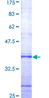 DERL1 / Derlin 1 Protein - 12.5% SDS-PAGE Stained with Coomassie Blue.