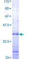 DERL1 / Derlin 1 Protein - 12.5% SDS-PAGE Stained with Coomassie Blue.