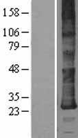 DERL2 / Derlin-2 Protein - Western validation with an anti-DDK antibody * L: Control HEK293 lysate R: Over-expression lysate