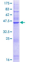 Derlin-3 / DERL3 Protein - 12.5% SDS-PAGE of human DERL3 stained with Coomassie Blue