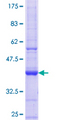 Dermatopontin / DPT Protein - 12.5% SDS-PAGE Stained with Coomassie Blue.