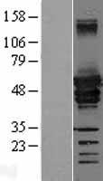 DES / Desmin Protein - Western validation with an anti-DDK antibody * L: Control HEK293 lysate R: Over-expression lysate