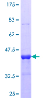 DES / Desmin Protein - 12.5% SDS-PAGE Stained with Coomassie Blue.