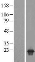 DESI1 / PPPDE2 Protein - Western validation with an anti-DDK antibody * L: Control HEK293 lysate R: Over-expression lysate