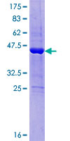 DESI1 / PPPDE2 Protein - 12.5% SDS-PAGE of human D15Wsu75e stained with Coomassie Blue