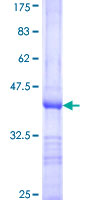 DET1 Protein - 12.5% SDS-PAGE Stained with Coomassie Blue.