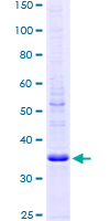 DEXI Protein - 12.5% SDS-PAGE of human DEXI stained with Coomassie Blue