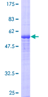 Dexras1 / RASD1 Protein - 12.5% SDS-PAGE of human RASD1 stained with Coomassie Blue