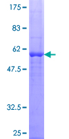 Dexras1 / RASD1 Protein - 12.5% SDS-PAGE of human RASD1 stained with Coomassie Blue