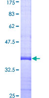 Dexras1 / RASD1 Protein - 12.5% SDS-PAGE Stained with Coomassie Blue.