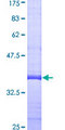 Dexras1 / RASD1 Protein - 12.5% SDS-PAGE Stained with Coomassie Blue.