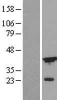 DFFA / ICAD / DFF45 Protein - Western validation with an anti-DDK antibody * L: Control HEK293 lysate R: Over-expression lysate