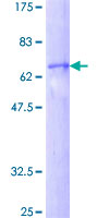 DFFA / ICAD / DFF45 Protein - 12.5% SDS-PAGE of human DFFA stained with Coomassie Blue