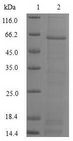 DFFA / ICAD / DFF45 Protein - (Tris-Glycine gel) Discontinuous SDS-PAGE (reduced) with 5% enrichment gel and 15% separation gel.