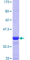 DFFA / ICAD / DFF45 Protein - 12.5% SDS-PAGE Stained with Coomassie Blue.